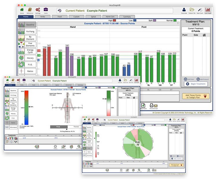 AcuGraph Graph in Overland Park KS